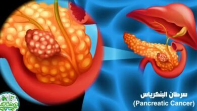 Revolution Medicines تحصل على موافقة أميركية لعلاج سرطان البنكرياس