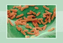 سحب جديد لبراعم الفجل في الولايات المتحدة بسبب E. coli والسالمونيلا.. FDA توسع تحذيراً غذائياً