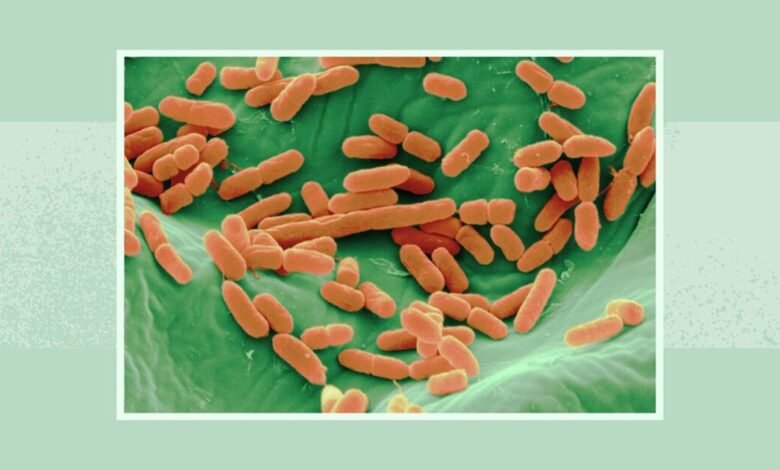سحب جديد لبراعم الفجل في الولايات المتحدة بسبب E. coli والسالمونيلا.. FDA توسع تحذيراً غذائياً
